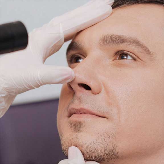 Nose Doctor in Carlsbad, CA